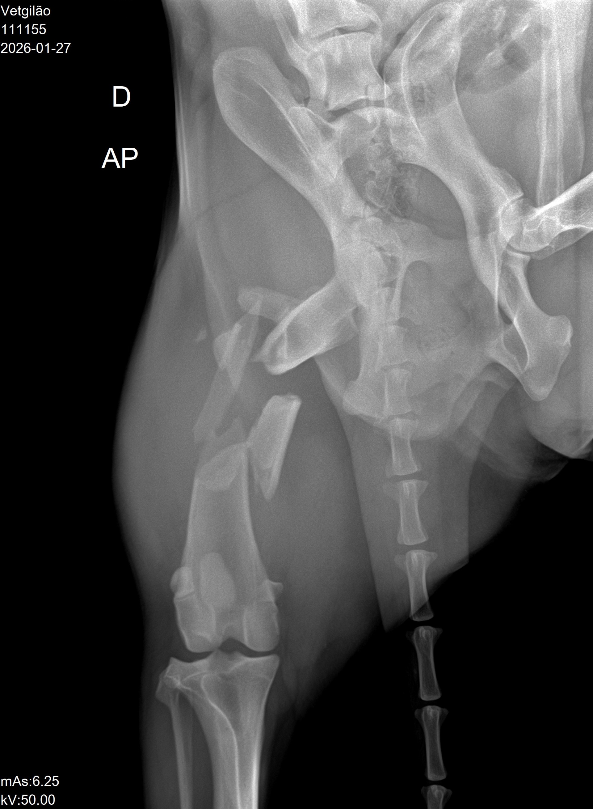 Max X-ray