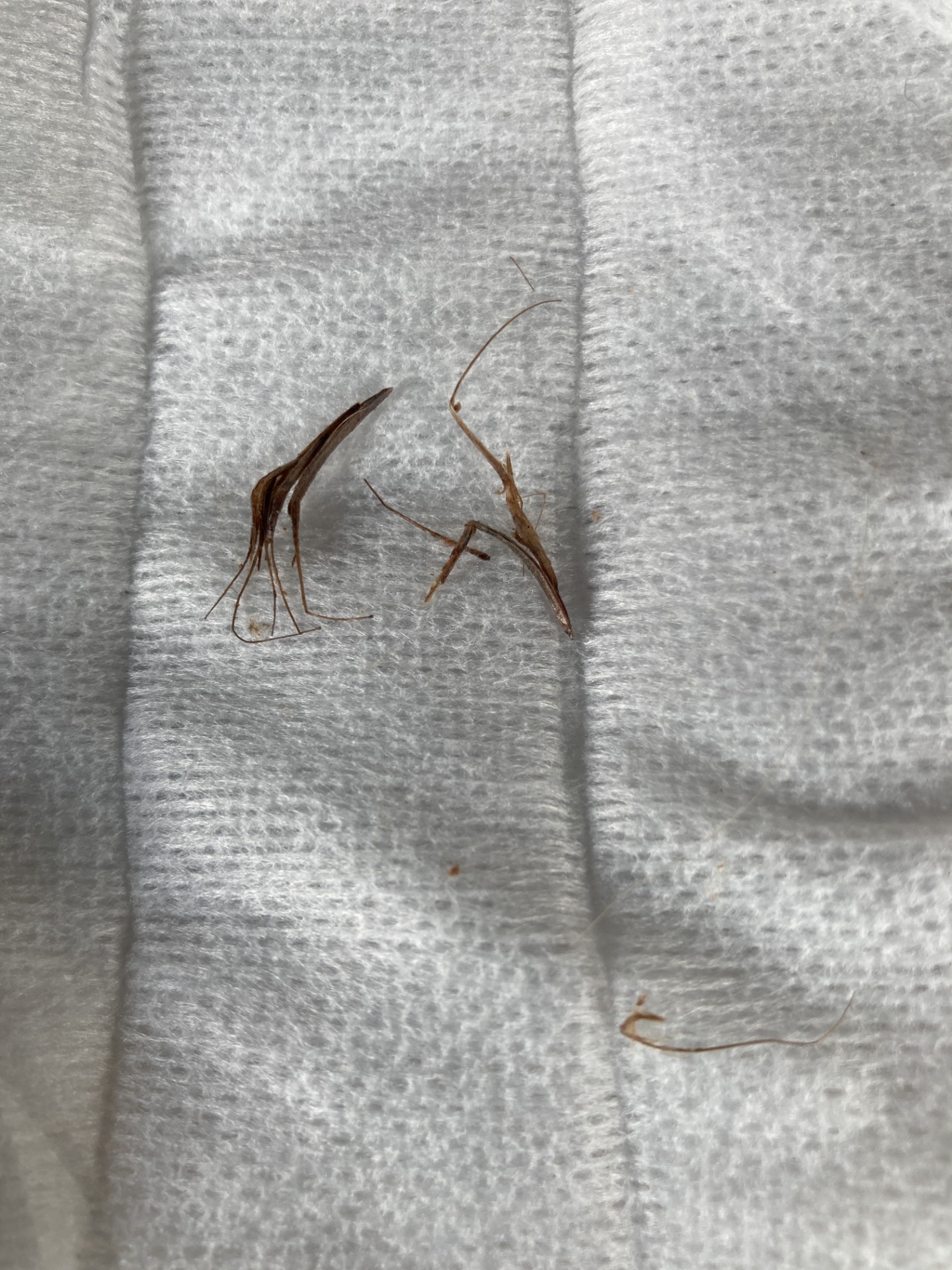 The grass seeds removed from Papi's ears